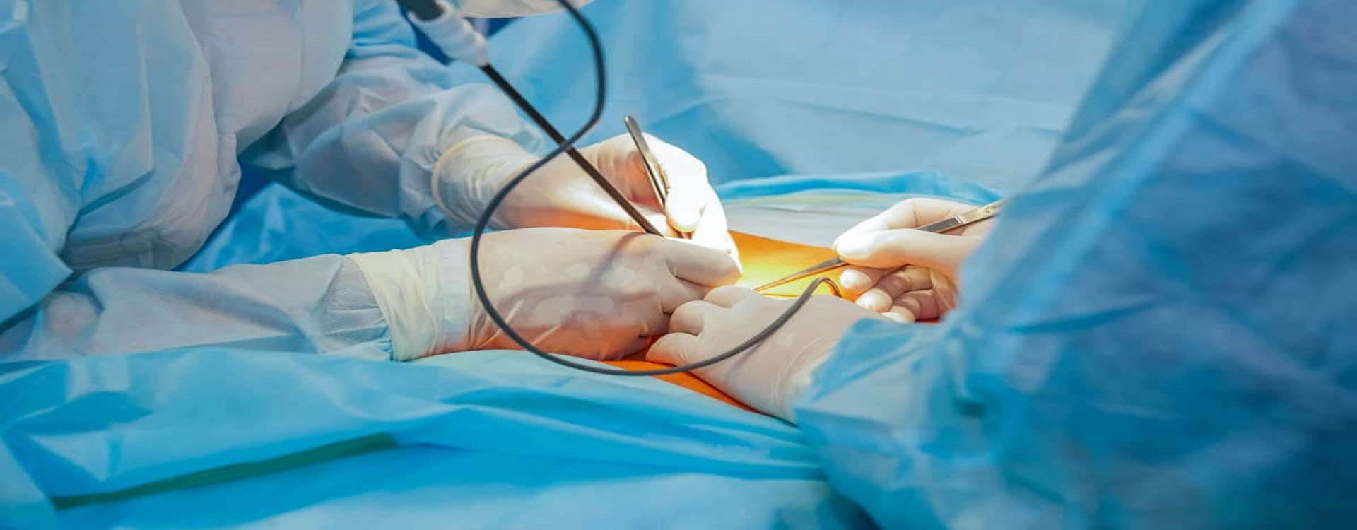 Laparoscopic surgeon in Faridabad